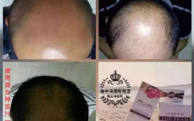 New Hair Growing After Using Top Team Hair Care Shampoo